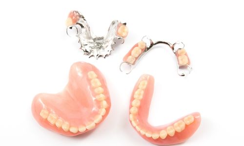 Beispiel: herausnehmbarer Zahnersatz