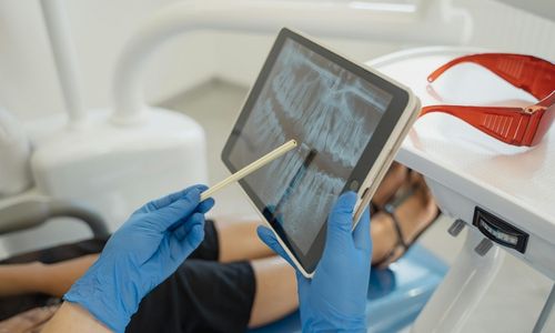 Belastung des Kausystems – Funktion und Bisslage im Alltag